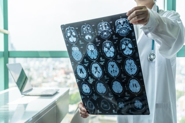 dementia research